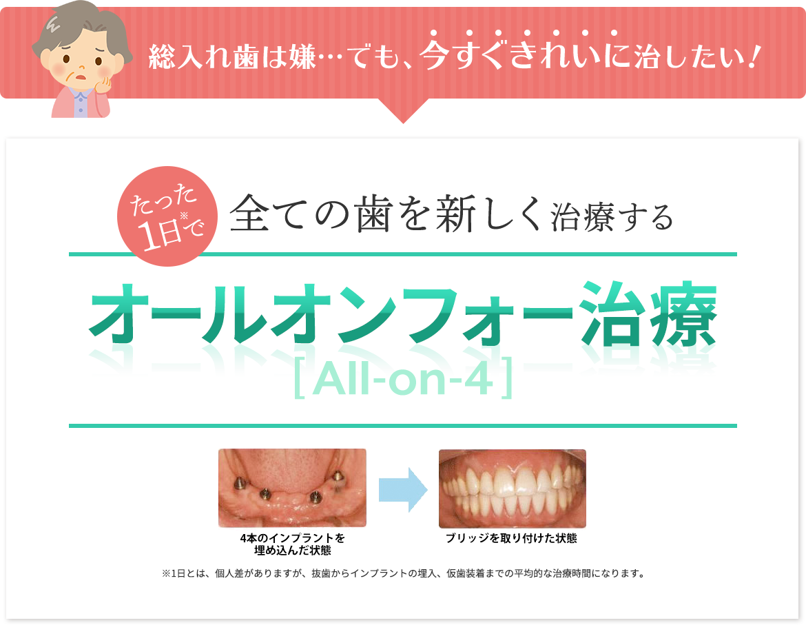 たった1日で全ての歯を新しく治療するオールオンフォー治療[All-on4]